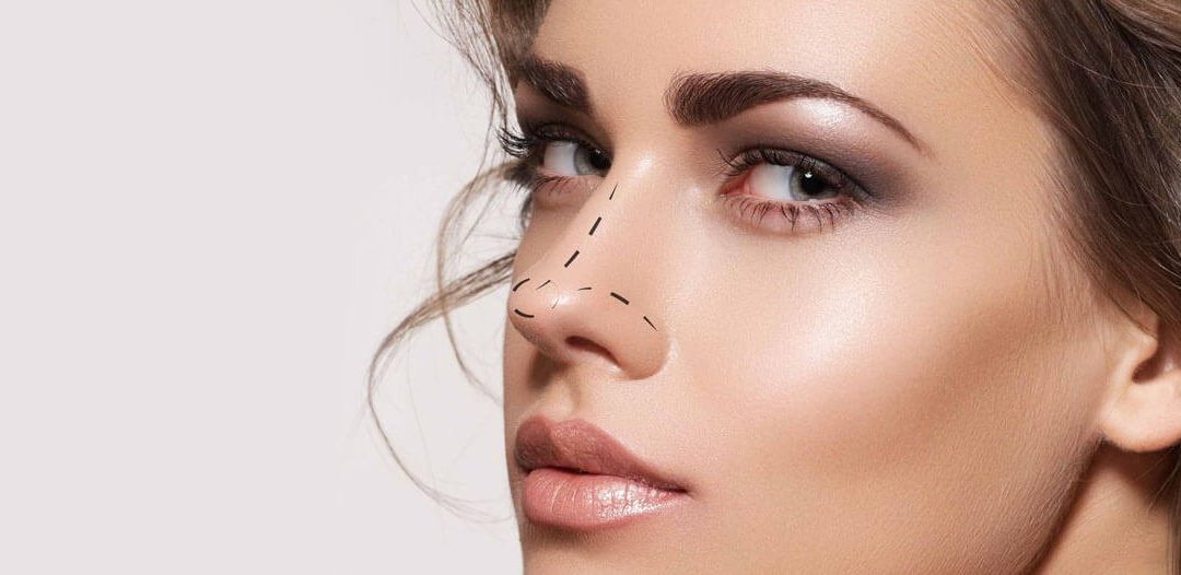 chirurgie plastique