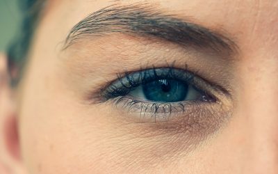 Tout savoir sur le botox sourcils avant après